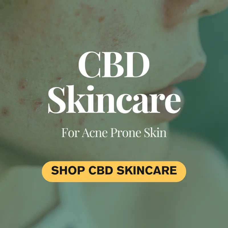 CBD Skincare for Acne-Prone Skin